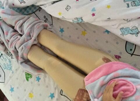 吸脂塑身医院推荐欧兰仁美医院，吸脂瘦腿恢复图分享
