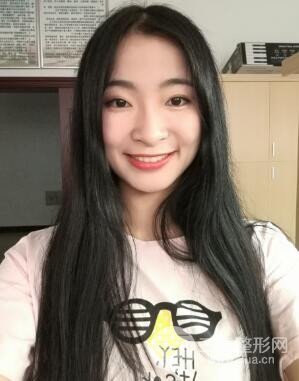 福州格莱美整形美容医院价格表,附瘦脸针案例