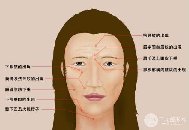 面部拉皮除皱手术有哪些优势