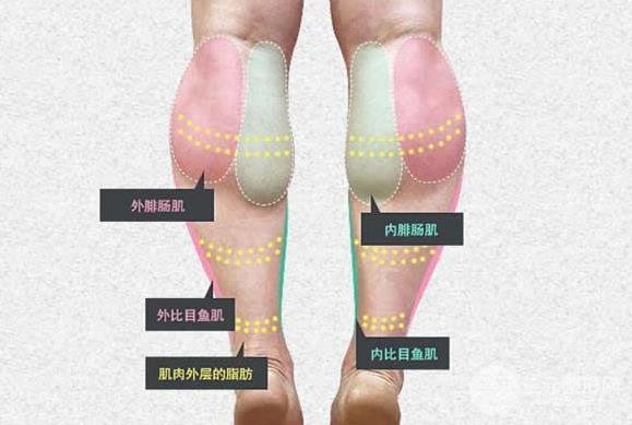 由于所有人的腿部基础不一样,也就是腓肠肌的厚薄水平不一样,术中是