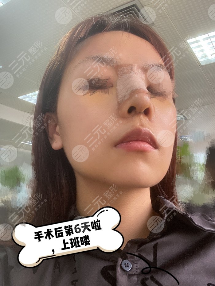 周柯做鼻子的风格怎么样?周柯做鼻子评论|做鼻子效果