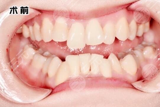 口腔医生信息 牙齿整形效果