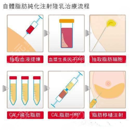 脂肪填充胸部可以维持多久有危险吗和假体哪个好美胸秘籍