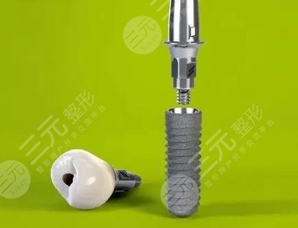 北大口腔医院种植牙价格公示