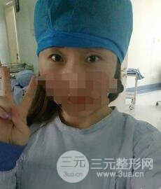 北京全切双眼皮手术真实案例，果对比图