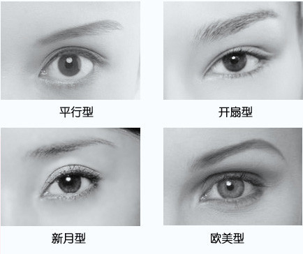 割双眼皮平行和扇形哪个好双眼皮平行和扇形的区别