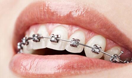 什么是,牙槽骨修整术,为什么