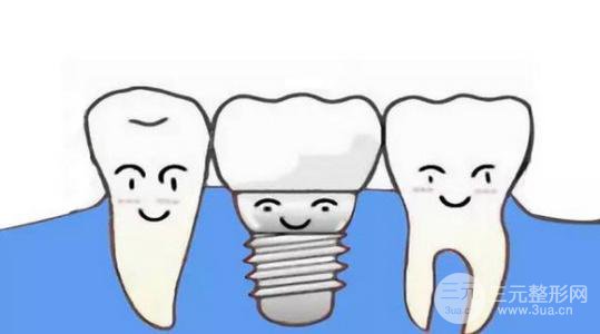 种植牙的过程 手术过程一览