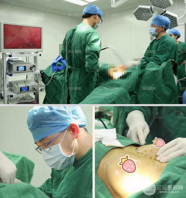 隆胸手术过程 真实图片