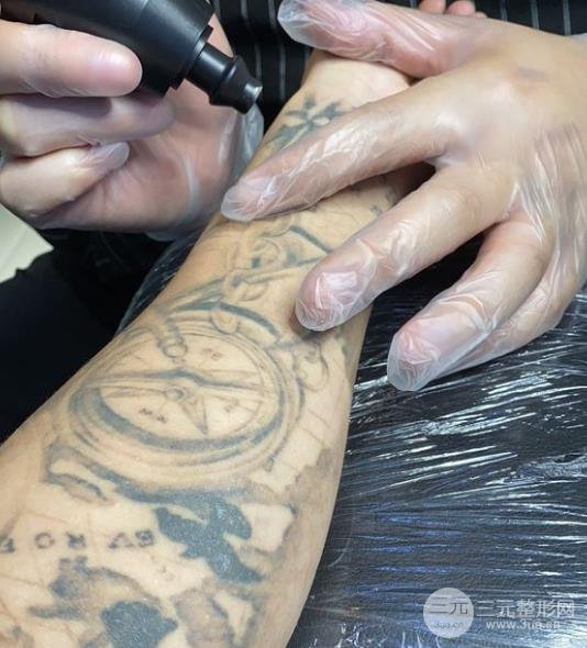 延安大学附属医院整形外科价格表洗纹身经历分享