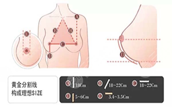 隆胸手术怎么做？案例图+科普解答，美胸无忧！