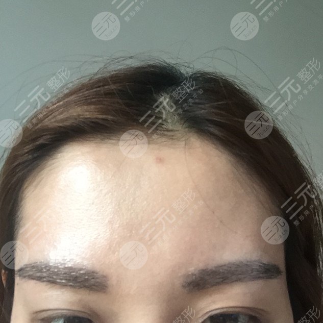 北京悦年轻医疗美容纹眉