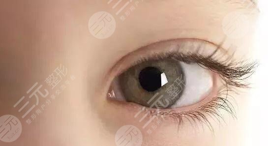 三点定位双眼皮的手术优势