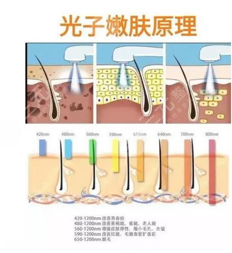 漳州175医院激光点痣多少钱?实力医生名单 地址电话一览