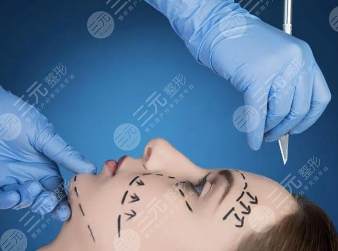 面部拉皮手术可以保持多久？面部拉皮手术降低风险吗？有哪些注意事项？