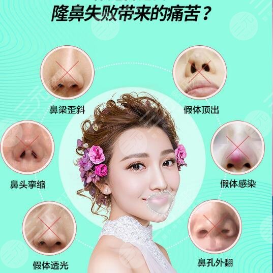 上海华美医疗美容医院科普鼻部整形