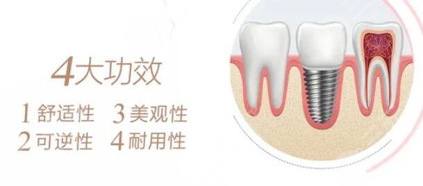 牙齿种植手术疼吗