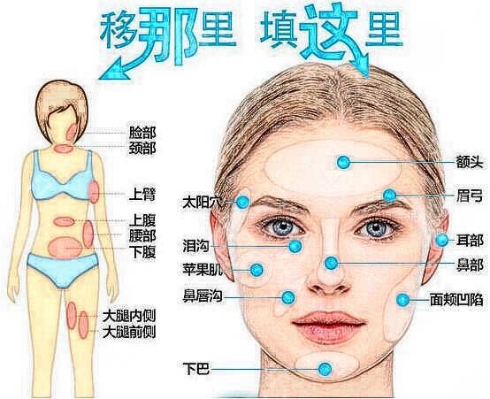 刘中国医生面部脂肪填充案例果图：手术之前