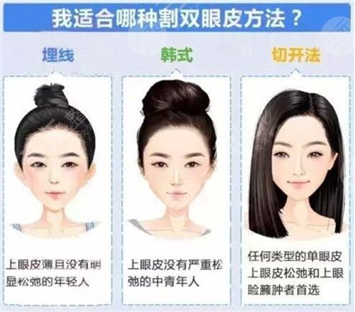 上海纽顿医疗美容双眼皮手术后8周