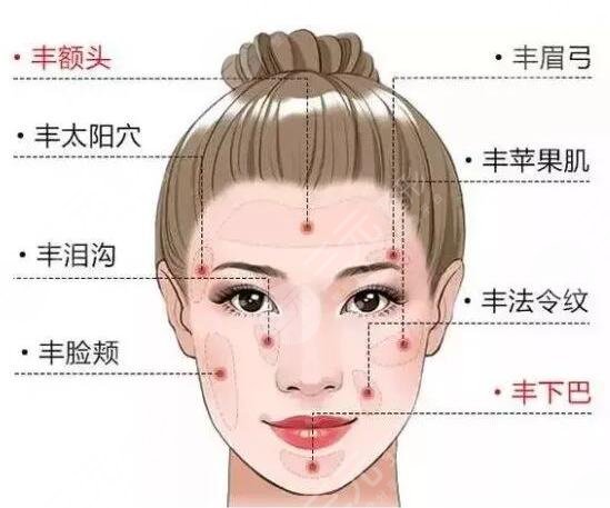 上海第九人民医院整形美容面部填充案例