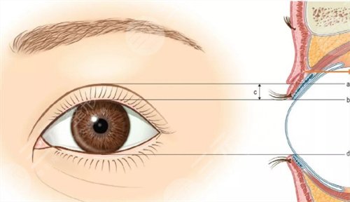 眼部日常的一些保养方式