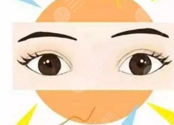 深圳私慕医疗美容双眼皮整形案例