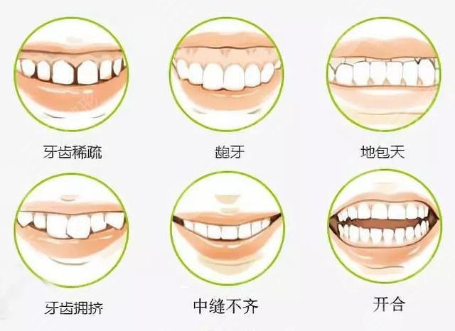 江津中心医院牙科牙齿矫正案例