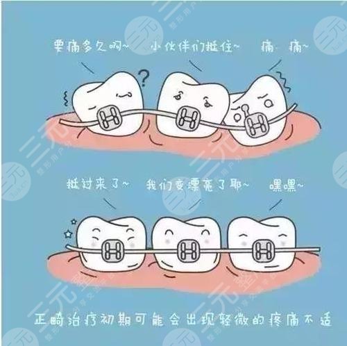 江津中心医院牙科牙齿矫正案例：术后