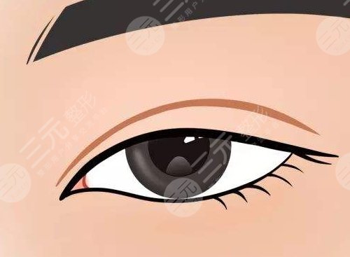 眼部抽脂的过程图