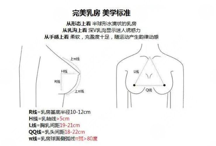 曼托假体隆胸案例图