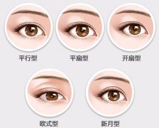 韩式or欧式双眼皮哪个好？区别是什么？对比分析，术前必看！