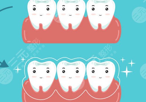 如何缓解牙齿松动问题？