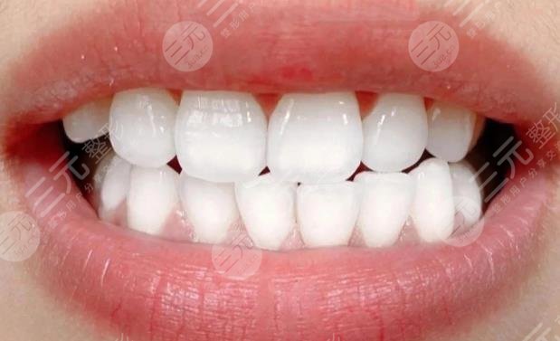 牙齿发黄变白的方法有哪些