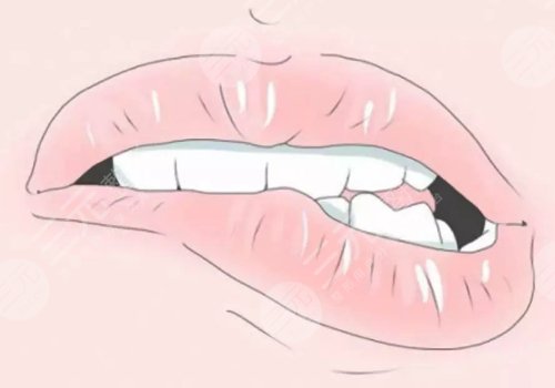 唇部老化的原因有哪些？唇部老化如何改良？