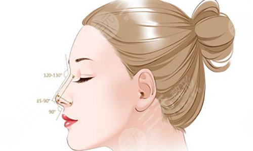 鼻子山根低做哪种隆鼻项目比较合适？美鼻指南！