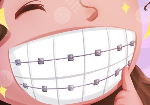 陕西省人民医院牙齿矫正多少钱