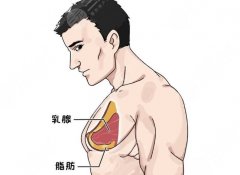 男生脂肪胸怎么瘦下来？胸部塑形指南，好身材这样打造！