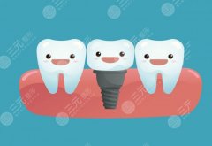 种植牙寿命是多少年？科普讲解，牙齿缺失修复5大常见问题！